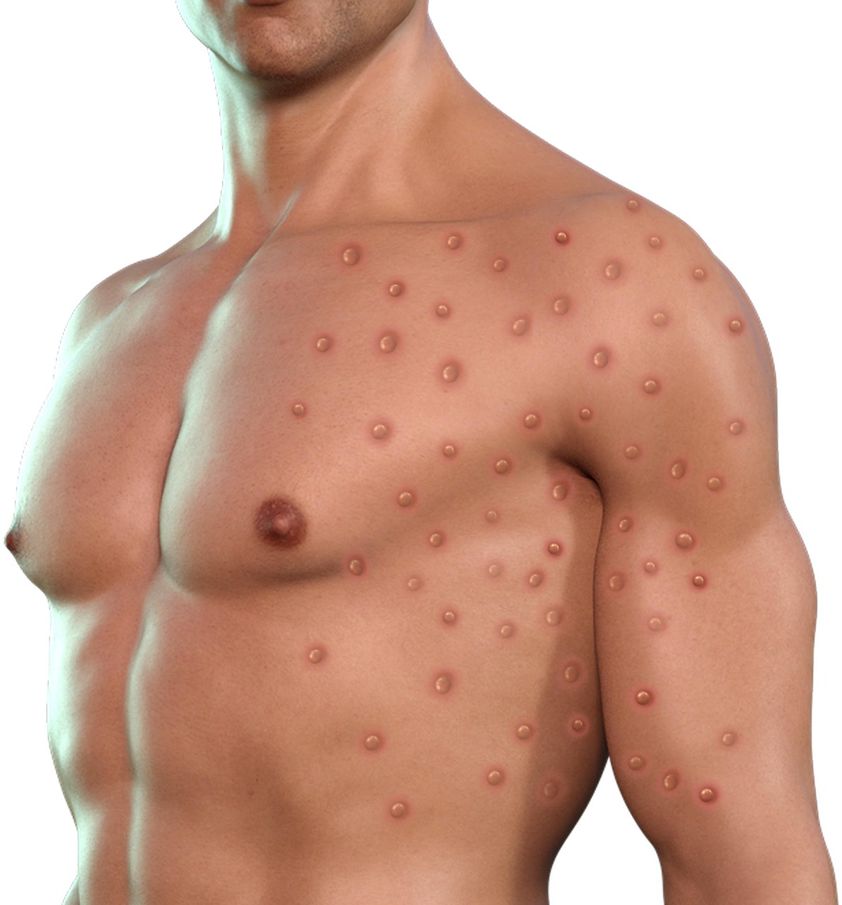 entdecken sie alles über autoimmunerkrankungen: ursachen, symptome, diagnose und behandlungsmöglichkeiten. informieren sie sich über die neuesten forschungsergebnisse und erhalten sie hilfreiche tipps für den umgang mit chronischen krankheiten.